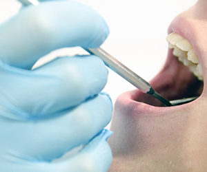 可能な限り、長期に渡って自分自身の歯を残していただくために、虫歯治療における根管治療は非常に重要な処置であると共に、熟練の歯科医師にとっても、根気と集中力・技術力が必要とされる大変な処置です。