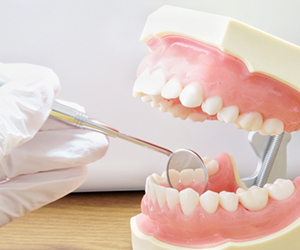 実際に自分の歯がきちんとあるうちは、歯はあって当たり前のもの