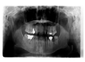 tooth09_09